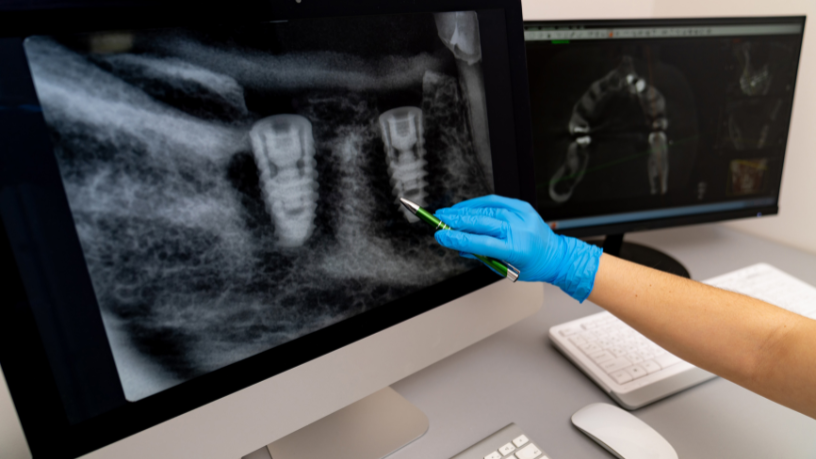 Garantir a qualidade na teleradiologia exige protocolos e atenção aos detalhes, como reforça Dr. Gustavo Khattar de Godoy.
